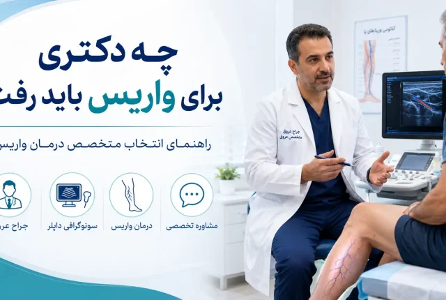 راهنمای انتخاب بهترین متخصص درمان واریس