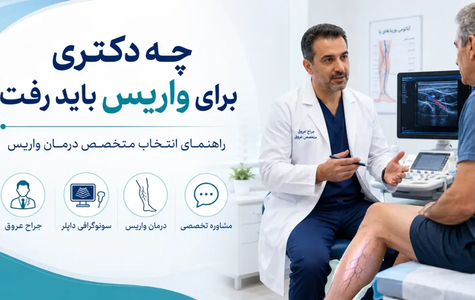 راهنمای انتخاب بهترین متخصص درمان واریس